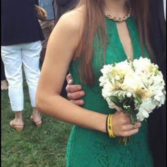 Green lace prom dress - Picture 6 of 9